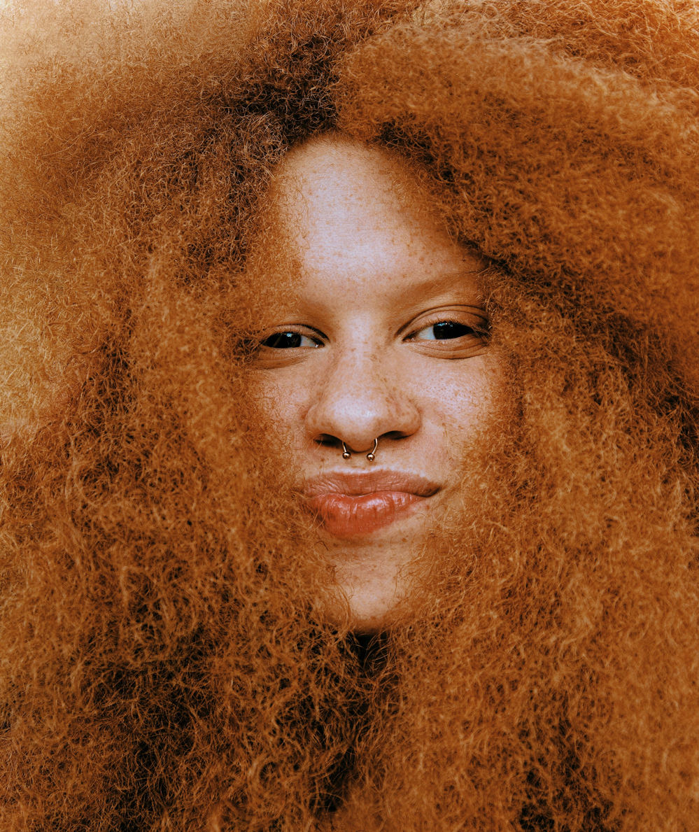 Best braces colors for red hair 👩🏼‍🦰 #drwindhorst #choiceorthodonti... |  TikTok